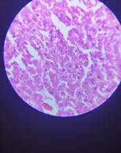 aroora histopathology